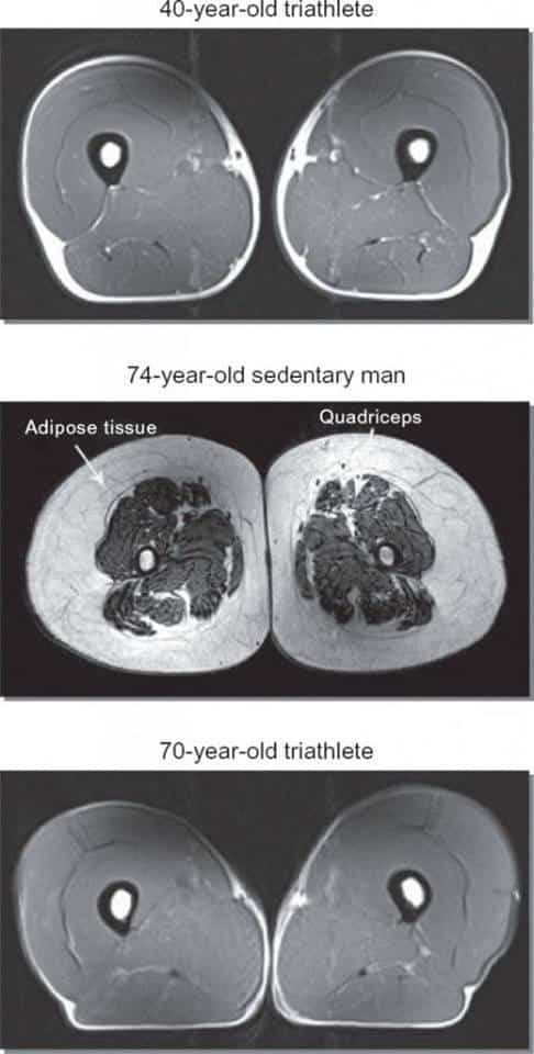 MRI of a 40 year old who runs and compare it to an MRI of a 74 year old that runs, the two images can look identical. You'll see plenty of muscle in the legs, very little fat and equal amounts of bone. If you throw in an image of an inactive 74 year old, you'll see someone with much more fat, much less muscle, and less bone. The risk of something bad happening to the inactive person is obvious.